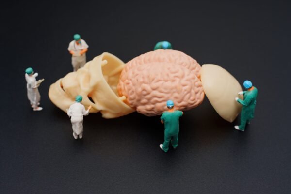 Miniature surgeon and doctor figurines performing a mock surgery on a small anatomical human brain model, medical concept photography